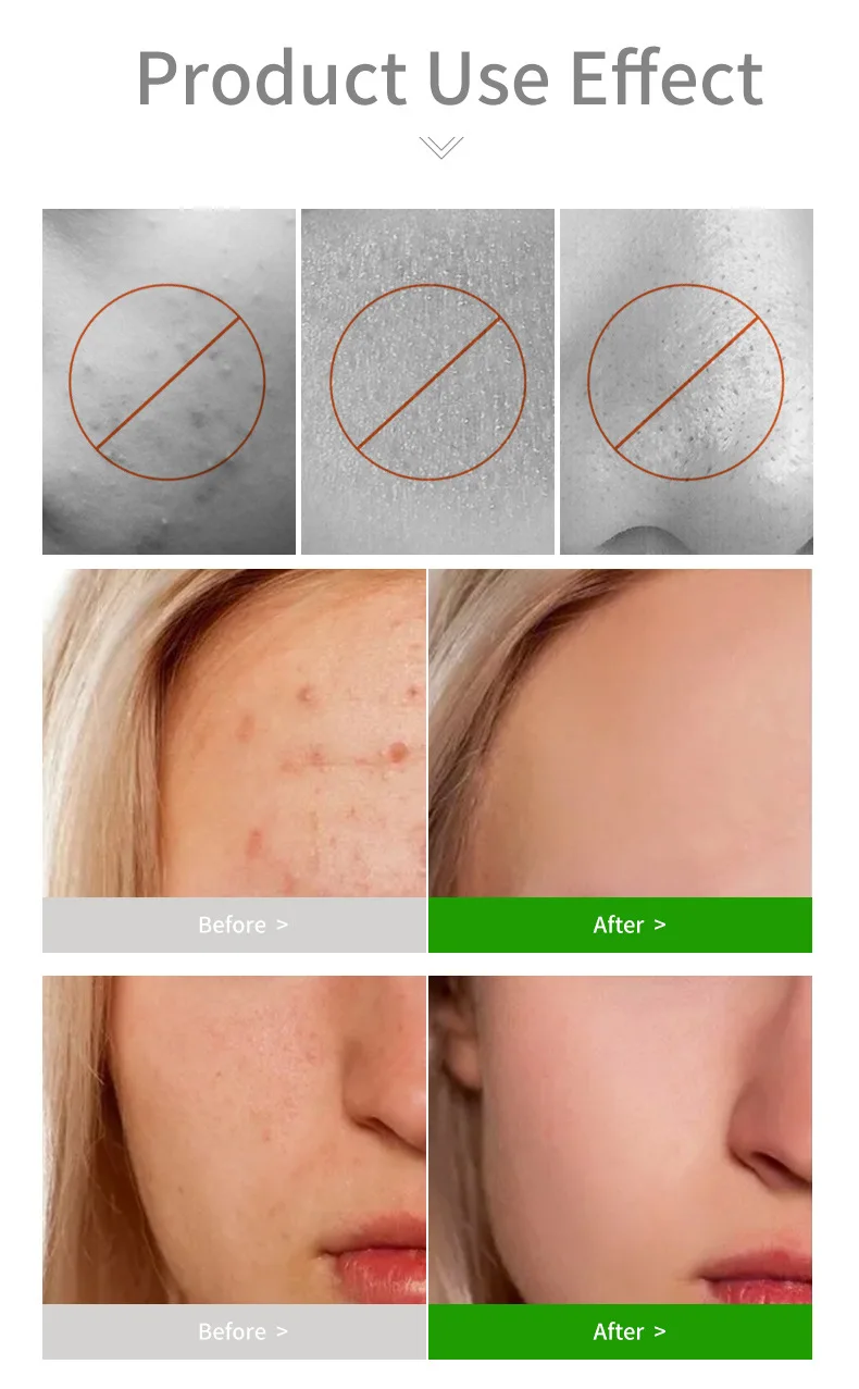 Продукты для отбеливания и ухода за кожей чайного дерева полный набор травяная Сыворотка лица Органическая Фирменная торговая марка от