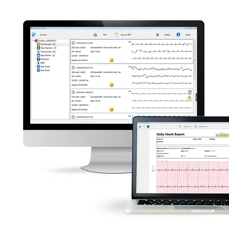 
Viatom Checkme Pro Doctor Blood Oxygen Pulse Rate Monitor ECG Portable Machine 