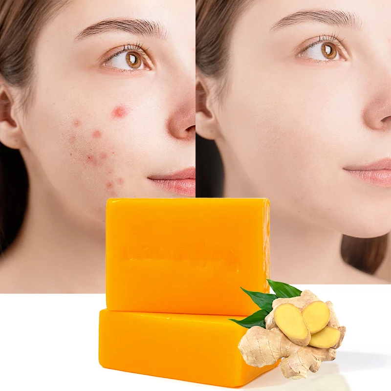 Private Label Organic Ginger Handmade Tumeric Bar Soap Bath Whitening Face Anti Acne Skin Brighten Kojic Acid Soap Turmeric Soap