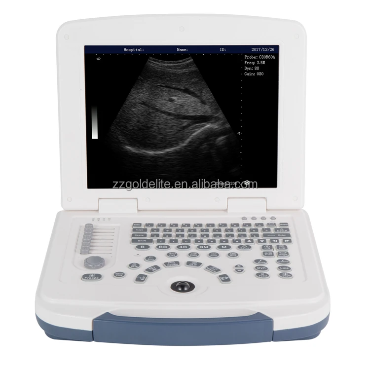 black and white portable ultrasound scanner portable ultrasound machine