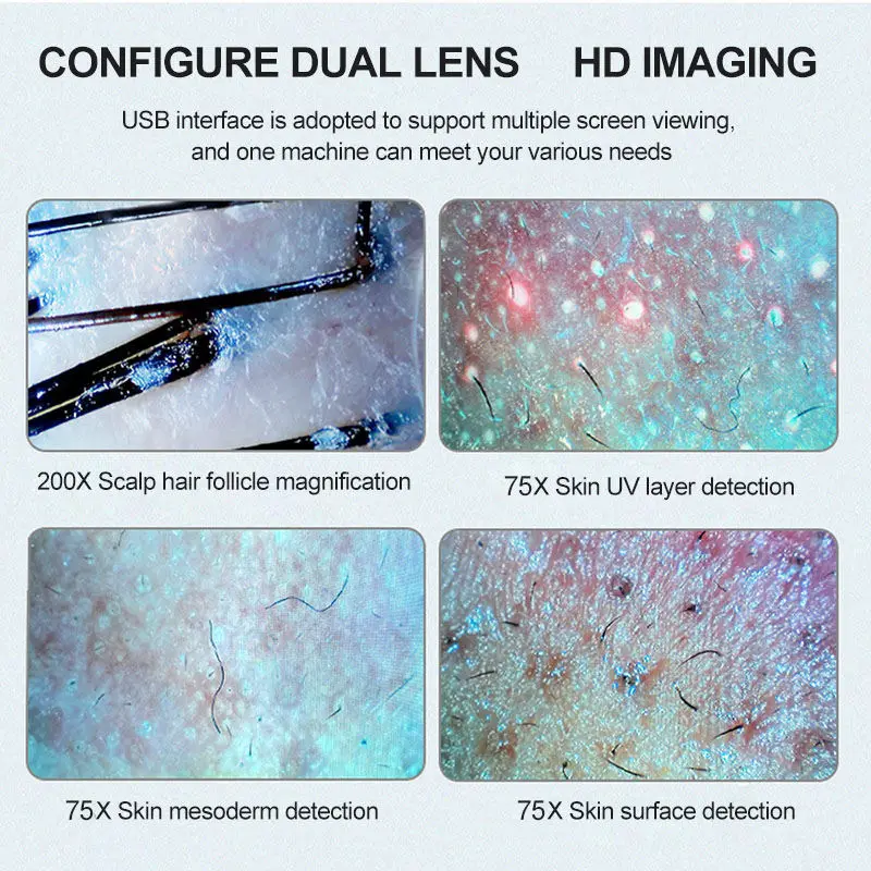 1080p high resolution 11 inch skin analyzer Hair follicle detector Hair analyzer head therapy special instrument