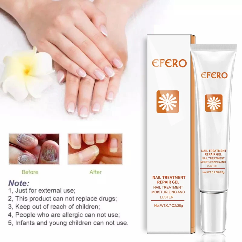 Feet Toe Care Treatment Foot Nail Fungus Removal Gel Anti Infection Paronychia Onychomycosis Fungal Nail Repair Essence Serum