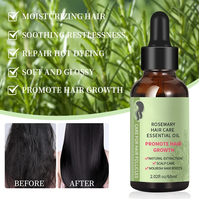 100% Pure Organic Rosemary Oil Nourishes Scalp Improves Blood Circulation Rid of Itchy & Dry Scalp Hair Care Oil 60ml