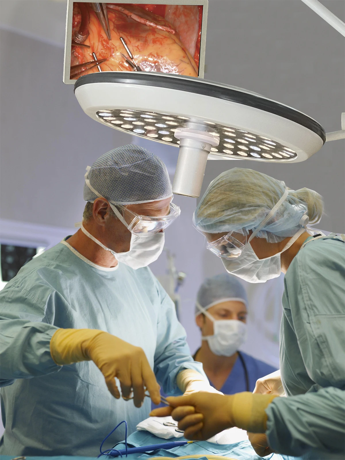 LED Surgical Operation Lamp 700mm/700mm dual heads Ceiling medical with camera operation light