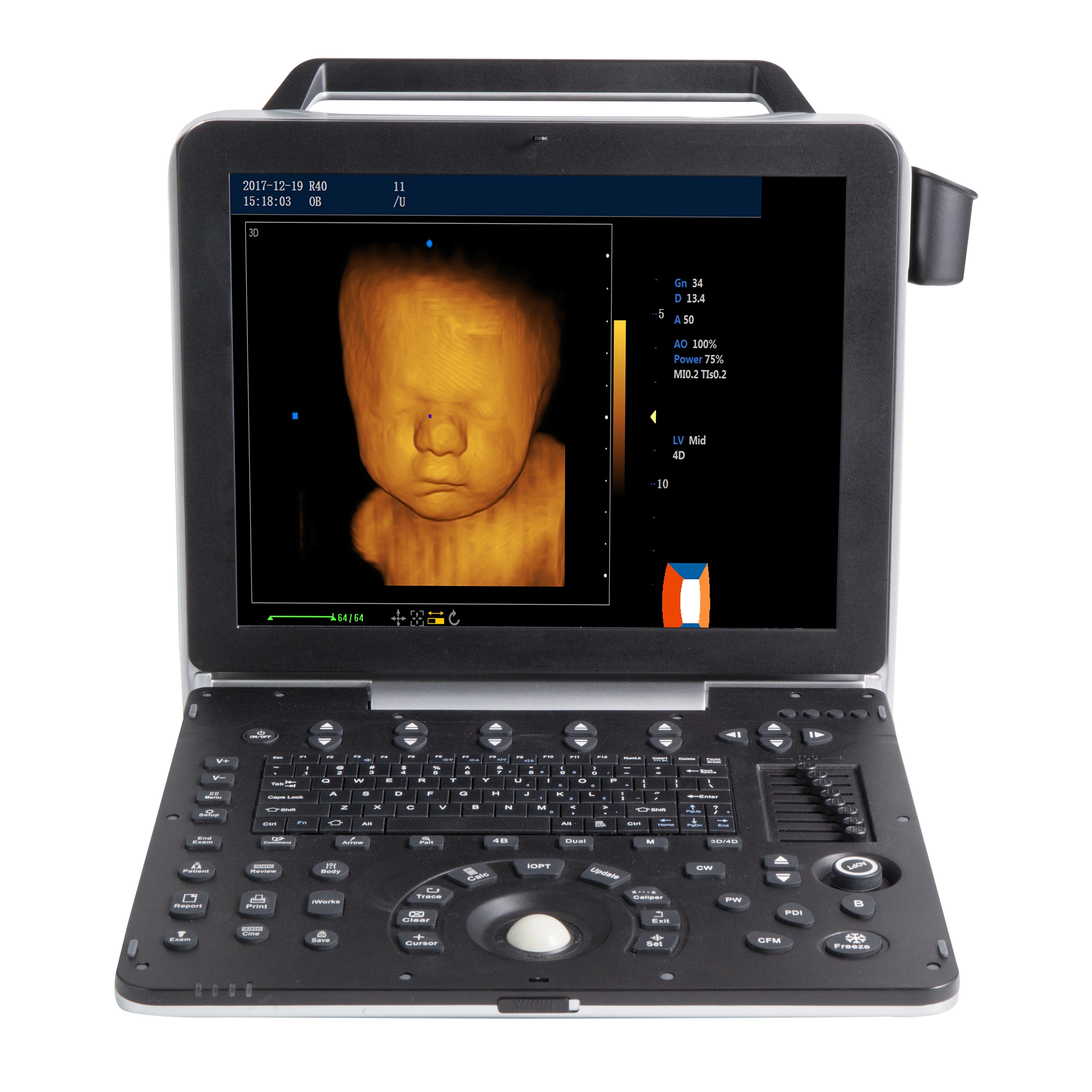Best price ultrasound scanner Echo echography echographe medical machine