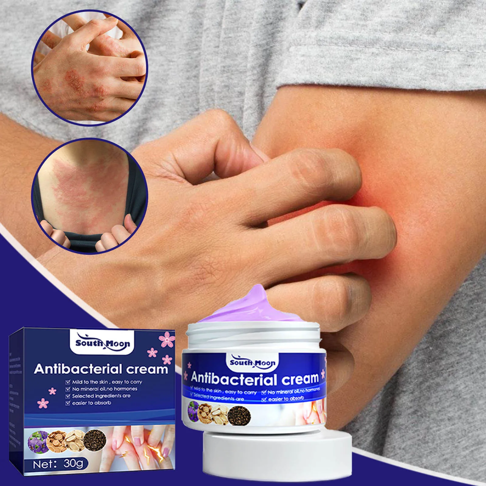 Anti-itching cream Provides Relief from Itching and Swelling for Mosquito Bites Insect Sting and Bite Relief