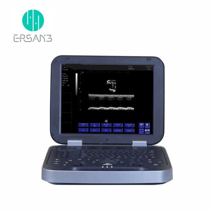 Hot Sale portable animals ultrasound Scanner Machine For cow horse Animal Veterinary Ultrasound with prode