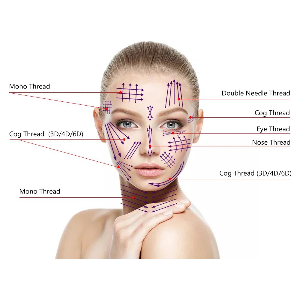 New Technology Pcl Type L Nose Cog Threads 21g 60mm For Nose Lifting