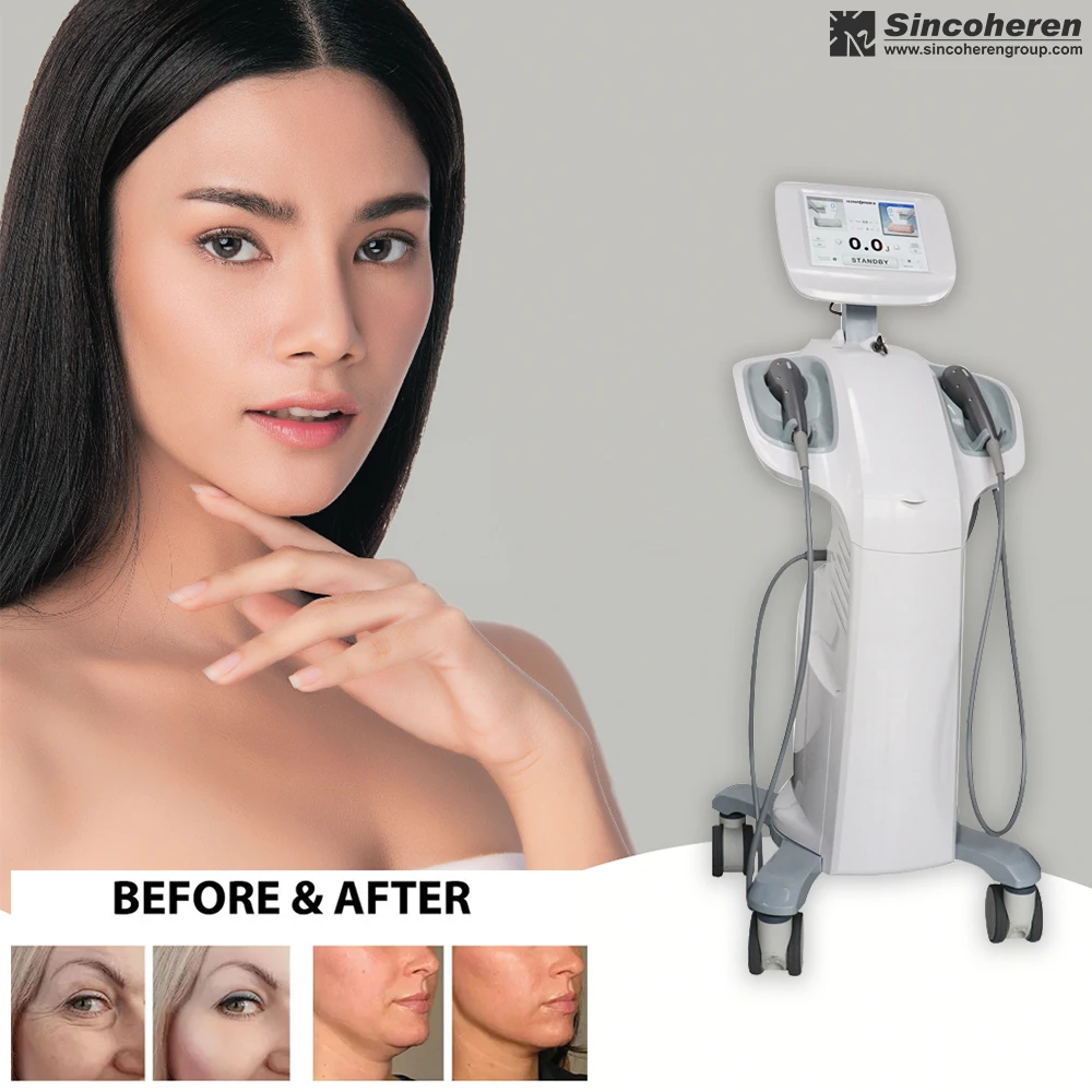 former 3 7d hifu smas face lifting Anti-wrinkle Korea face lifting Machine with 7 cartridge  III