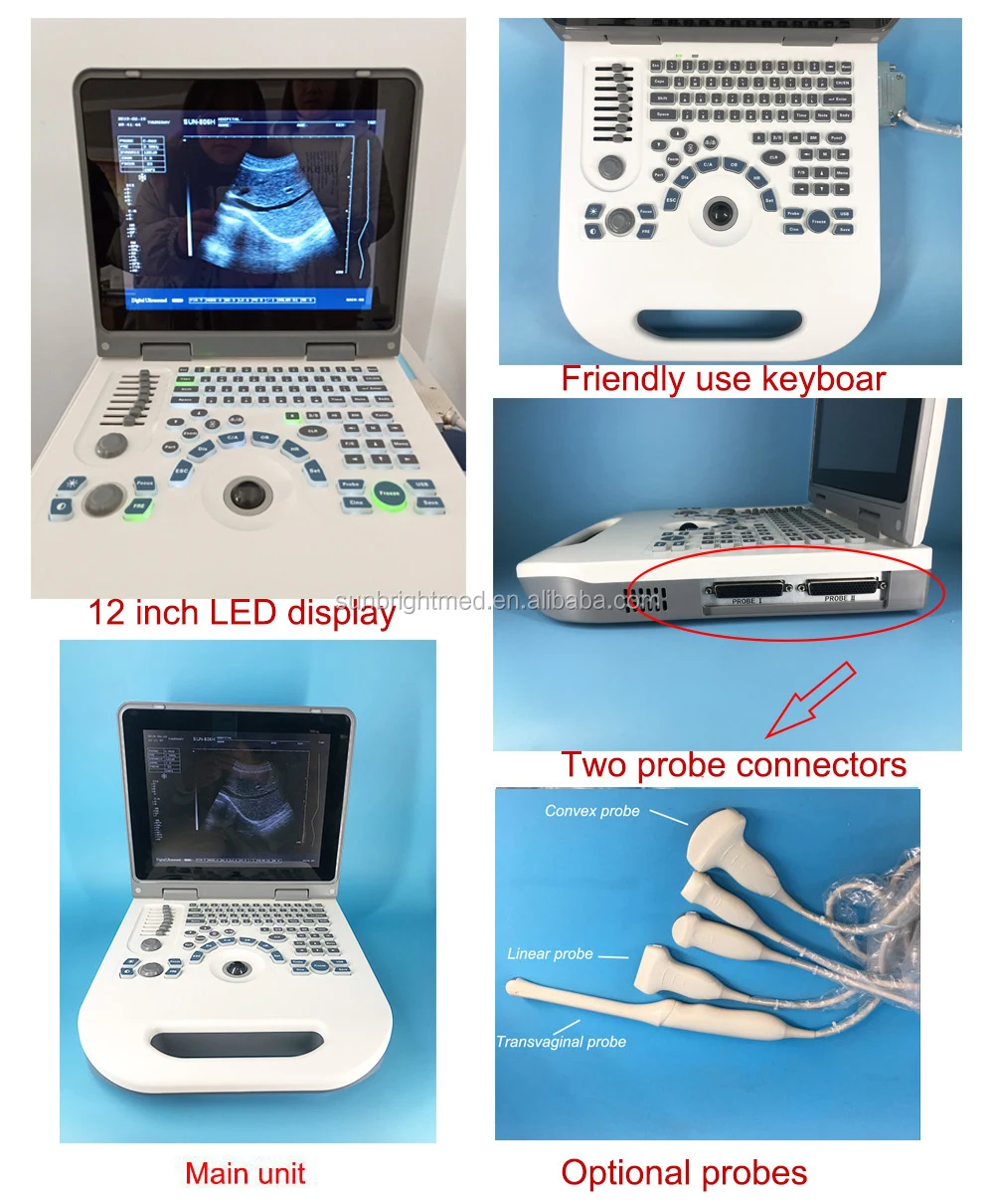 Hospital used Medical Equipment Portable veterinary animal ultrasound device