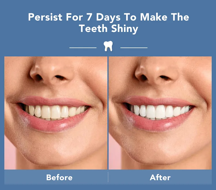 
Beautiful Smile Wholesale Hot Sale Pink Series Home Teeth Whitening Kit With Private Label 