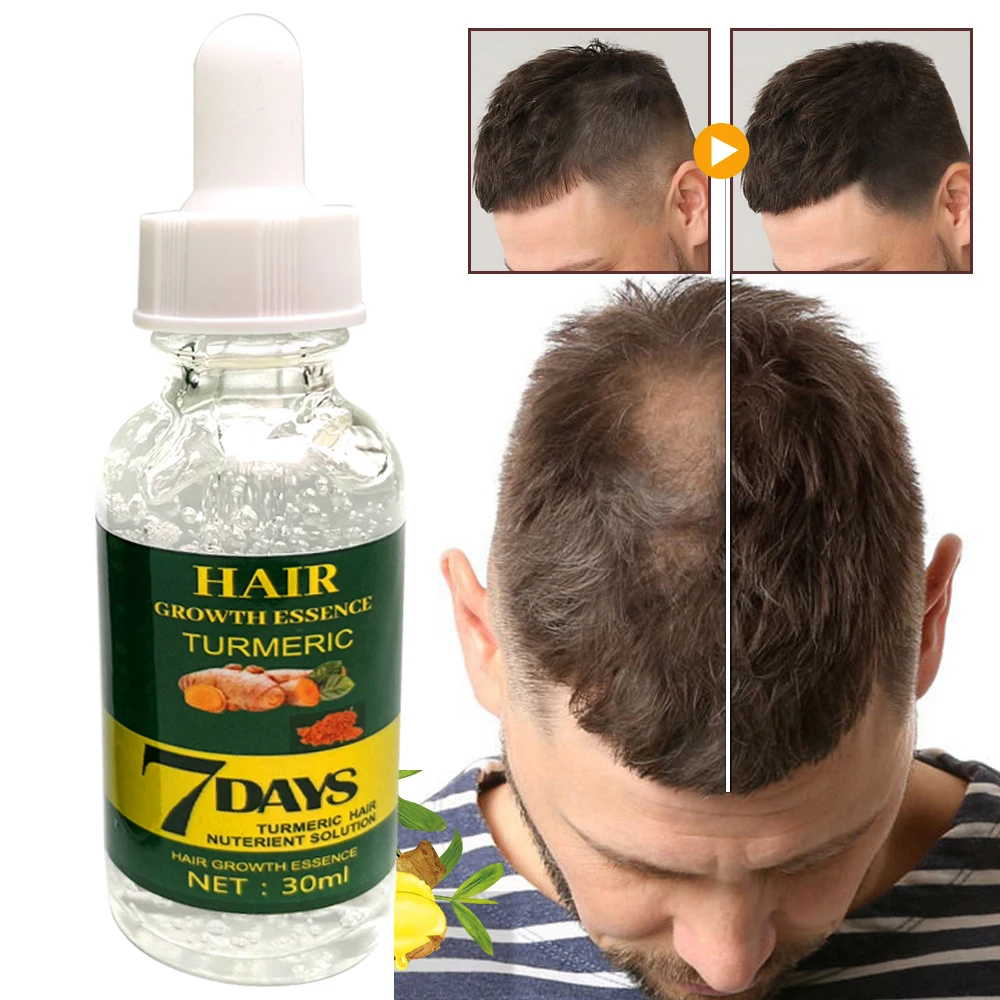 Private Label Natural Organic Vegan Treatment for Bald Hair Serum Wholesale Herbal Anti Hair Loss Boosting Hair Growth Oil