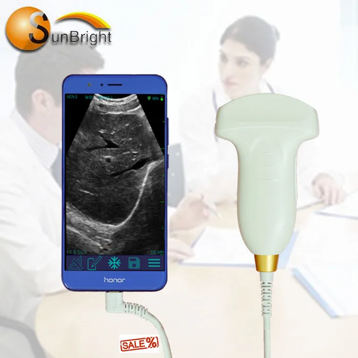 SUN-P1 ultrasound machine display USB convex probe smart phone computer convex probe price