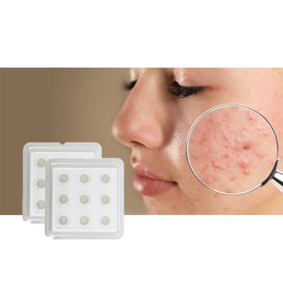 OEM Service Make Up Face & Skin Microneedling Pimple Acne Zit Patches for Face