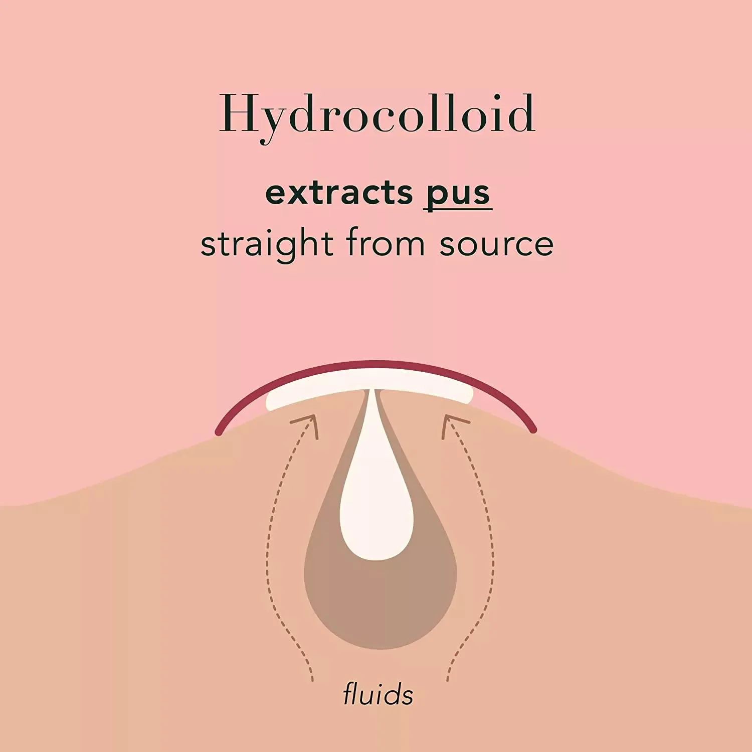 dots for spots anti pimple patch stickers cute package Salicylic acid Granules Acne patch Invisible acne printing acne patch