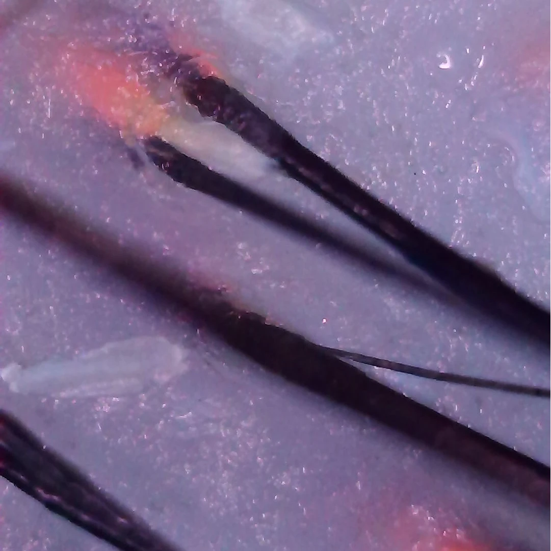 Skin Scalp Hair Tester Pen