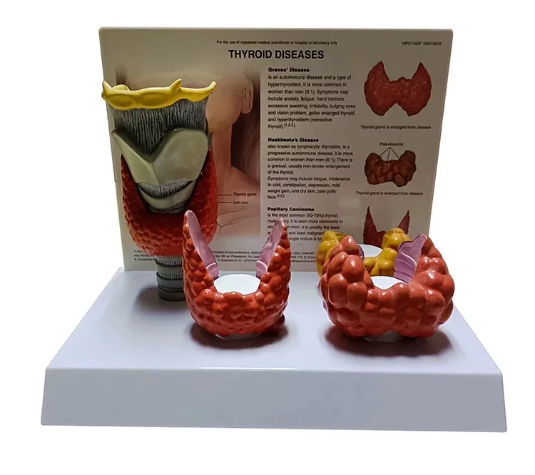 Medical Sciences Human Thyroid Pathology  Disease Model  Organ Disease Model Anti Drug Model