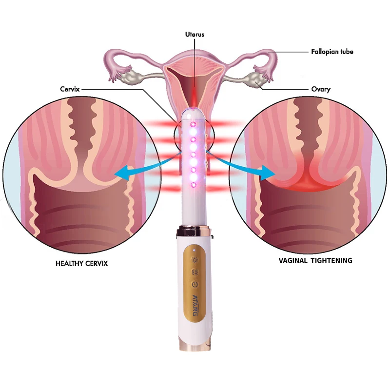 ATANG Vaginal Hemorrhoids Treatment Device Vaginal Vibrator for Vaginal Tightening Bacterial Pelvic Inflammatory Disease