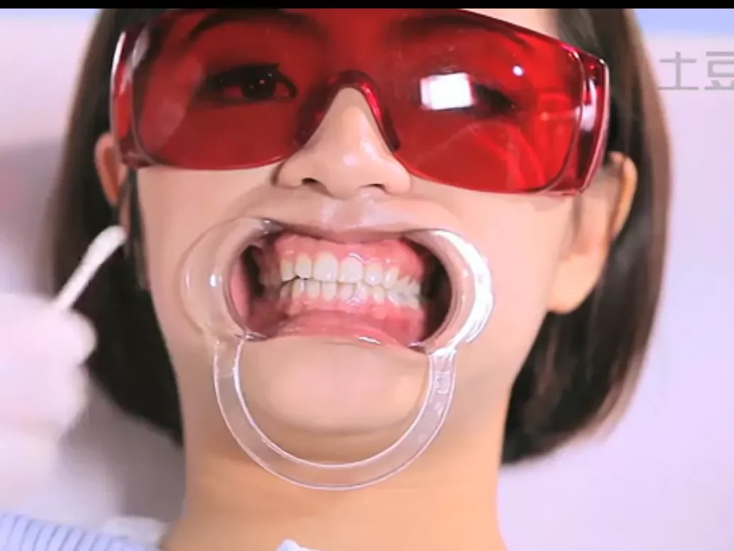 Teeth Whitening Safety Laser Glasses Eye Protection Laser Protective Goggles Other Teeth Whitening Accessory