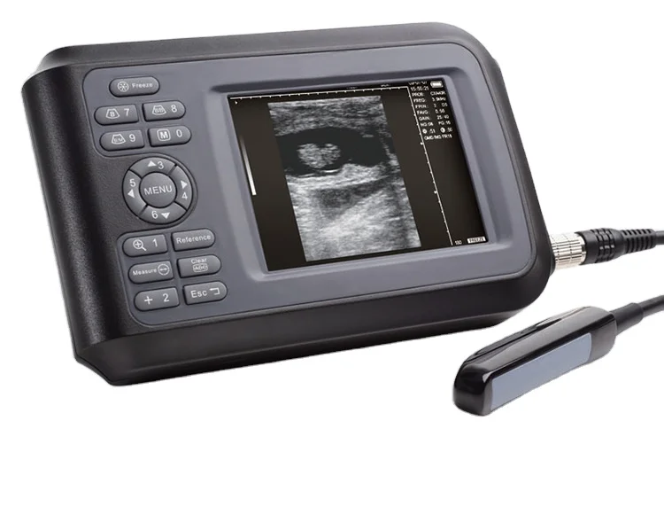 Medical Full Digital Laptop Veterinary Ultrasound Scanner A Sheep Horse Pig Farm Rectal Ultrasound