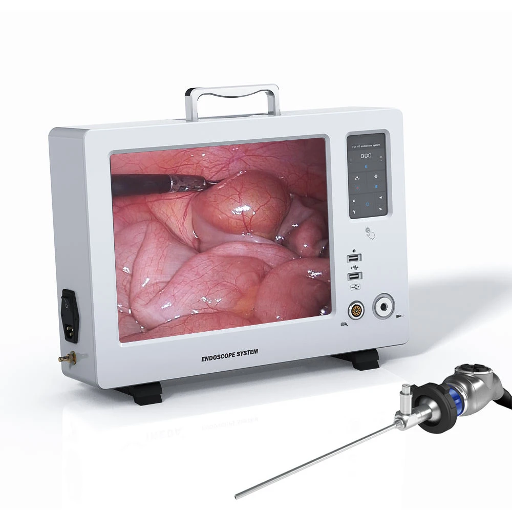 Integrated portable endoscopy camera unit 1080P for ENT