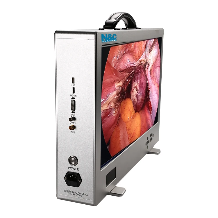 China Best Supplier 24 inch Medical Diagnostic Equipment Video Camera FULL HD 1920x1080P