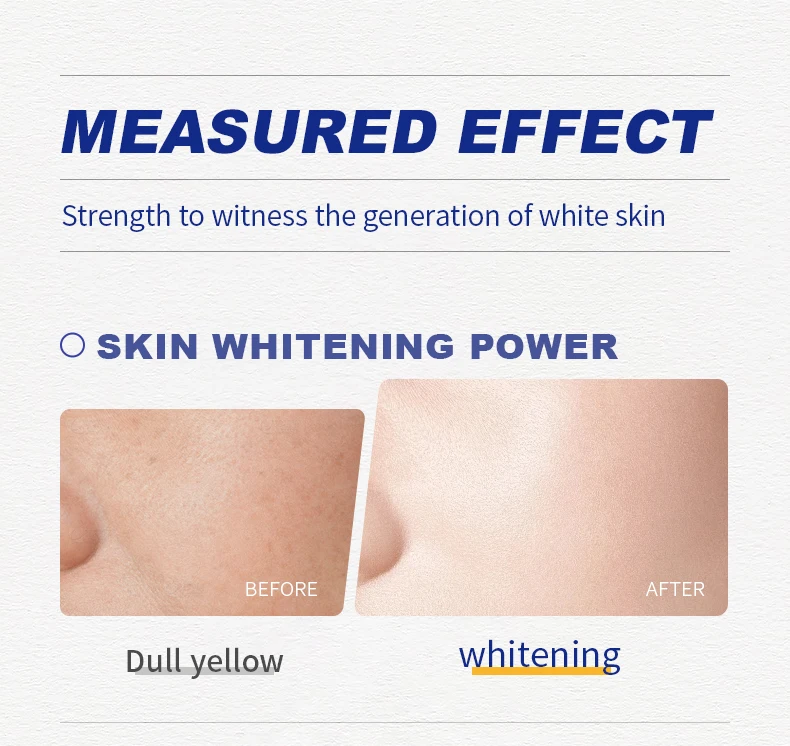 Private Label Freckle cream Nicotinamide Whitening Cream essence