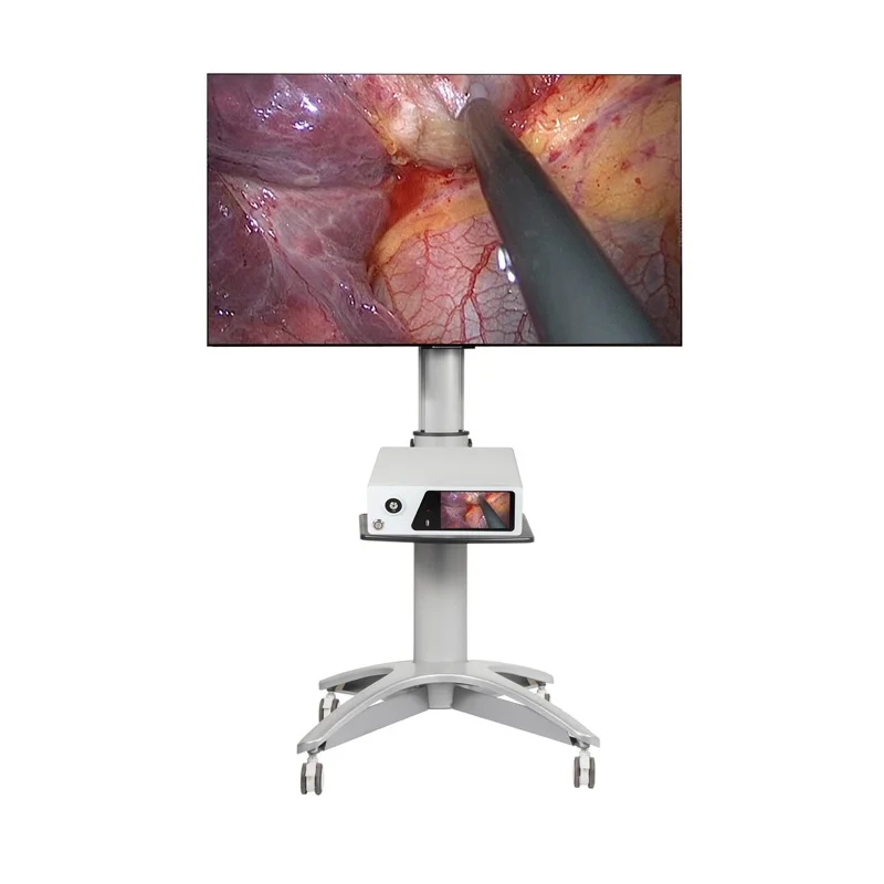 4k  fluorescence  Medical portable  endoscope camera for fiber endoscopic HD with light source