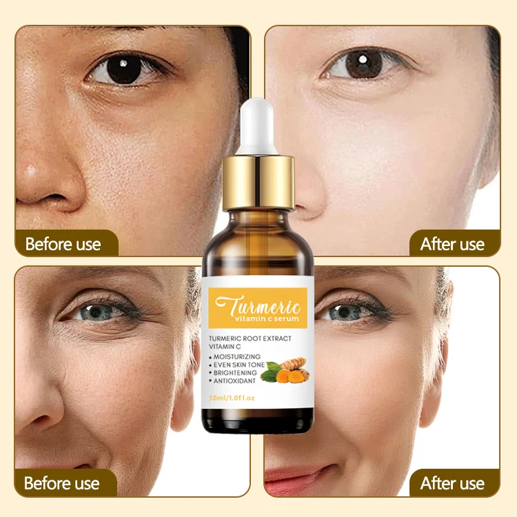 Private Label Face Facial Skin Care Serum Anti Acne Antioxidant Dark Spot Correcting Vitamin C Turmeric Serum