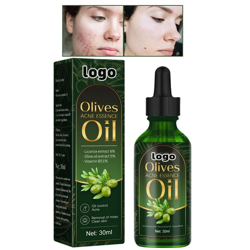 Custom Natural Facial Skin Care Serum Spot Treatment Targets Redness Olives Acne Essence Oil