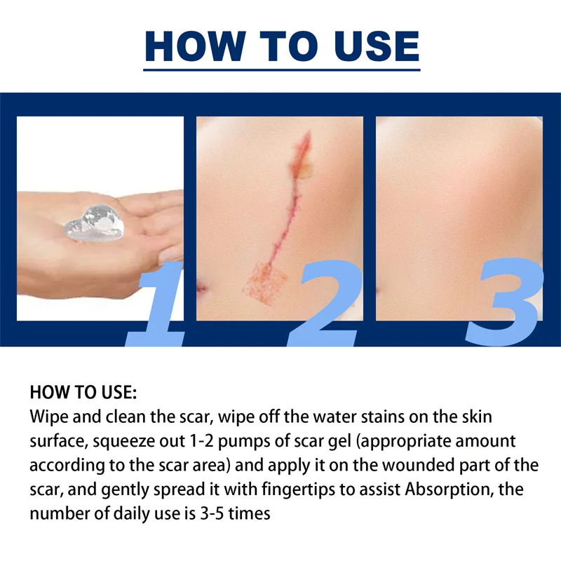 Jaysuing silicone anti scar gel hydrating repairing softening smoothing scars empyrosis fat line pregnancy stria removing gel
