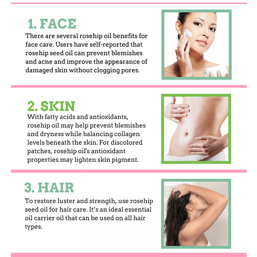 Wholesales Firming Brightening Moisturizing Smoothing Face Skin Hair Organic Cold Pressed Pure and Natural Rosehip Oil