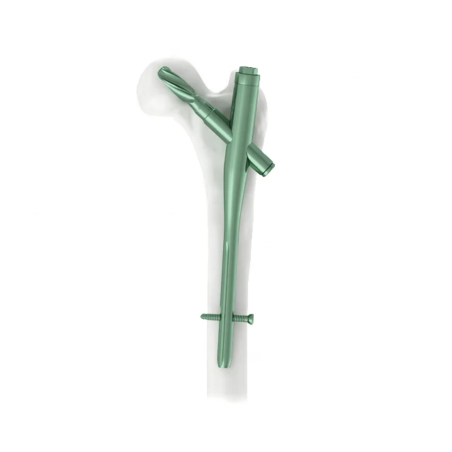 new products PFNA Intramedullary Interlocking Nail orthopedic instrument;Orthopedic materials and orthotics