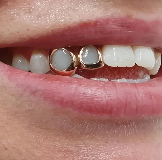 1pc Newest Model Metal Style Hollow Teeth Grillz, Unisex Party Tooth Jewelry