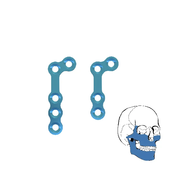 Orthopedic Comprehensive Competitive Price 110 DegreeL-shaped Plate 1.0mm Thickness