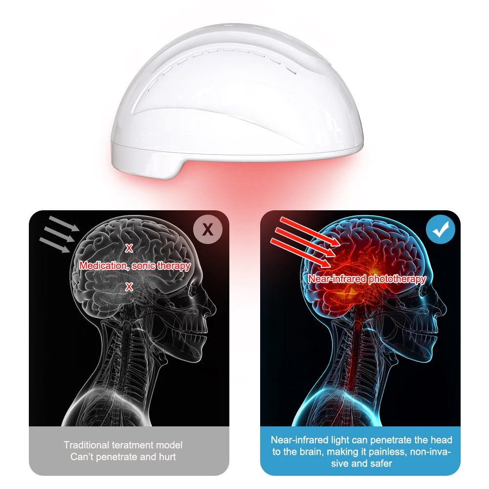 Suyzeko Brain Health Stimulator Parkinson Dementia Healing 810nm Lights Therapy Device Infrared Light Photodynamic Helmet