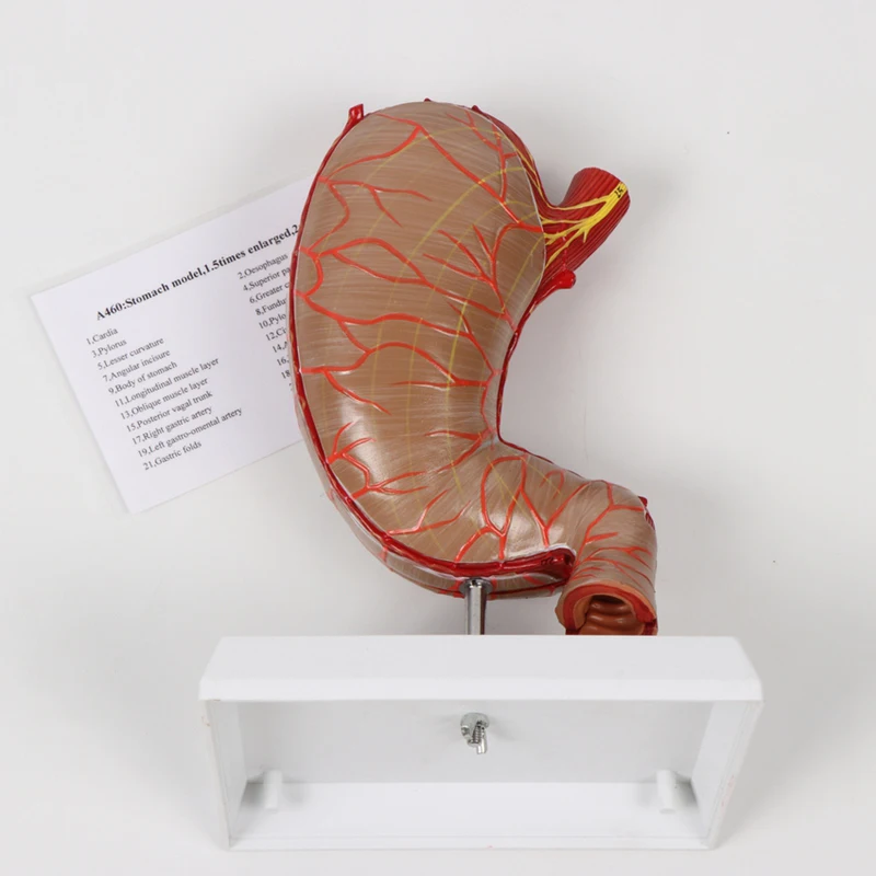 Human Plastinated Specimen Human Body Anatomy Model Stomach Model