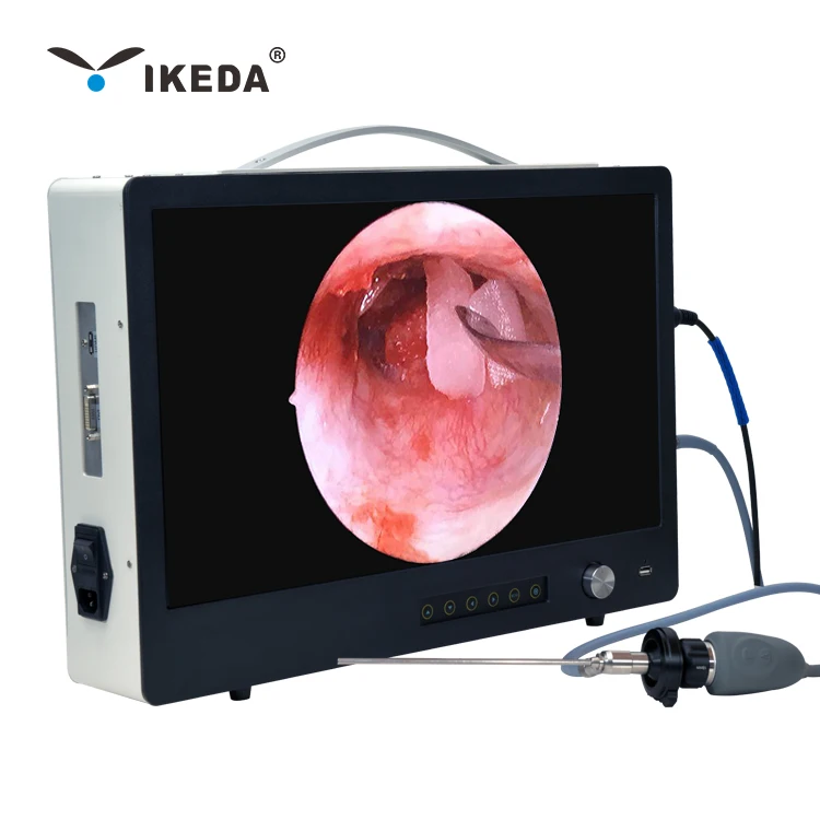 YKD-9122 портативный эндоскопическая/эндоскоп HD камера для