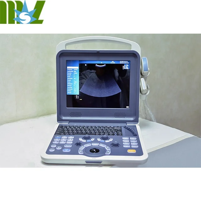 2d /3d/4d medical ultrasound machine toshiba