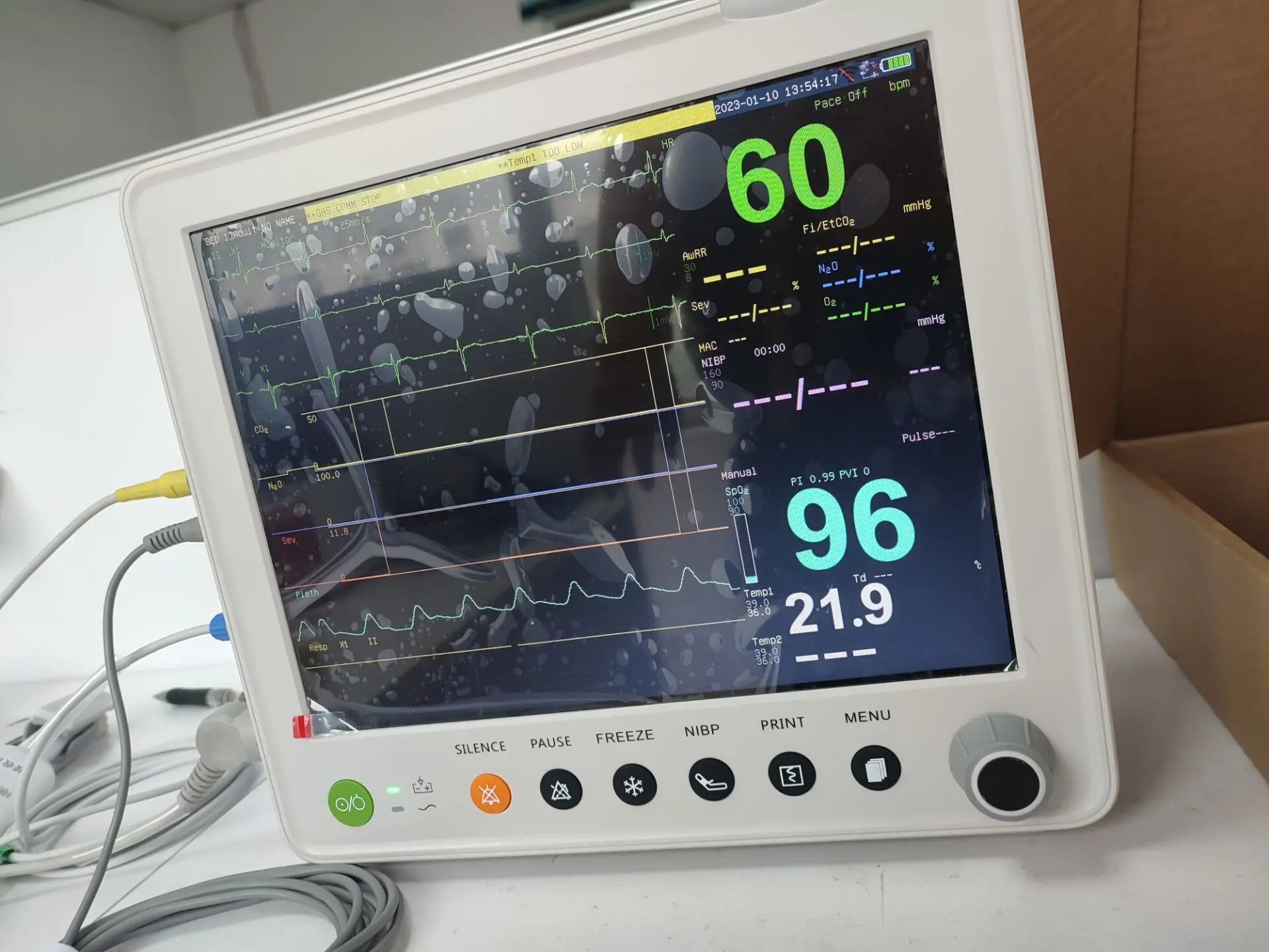 12 1 дюймовый ЭКГ-монитор Capnograph Etco2 портативный монитор мониторы для новорожденных Spo2