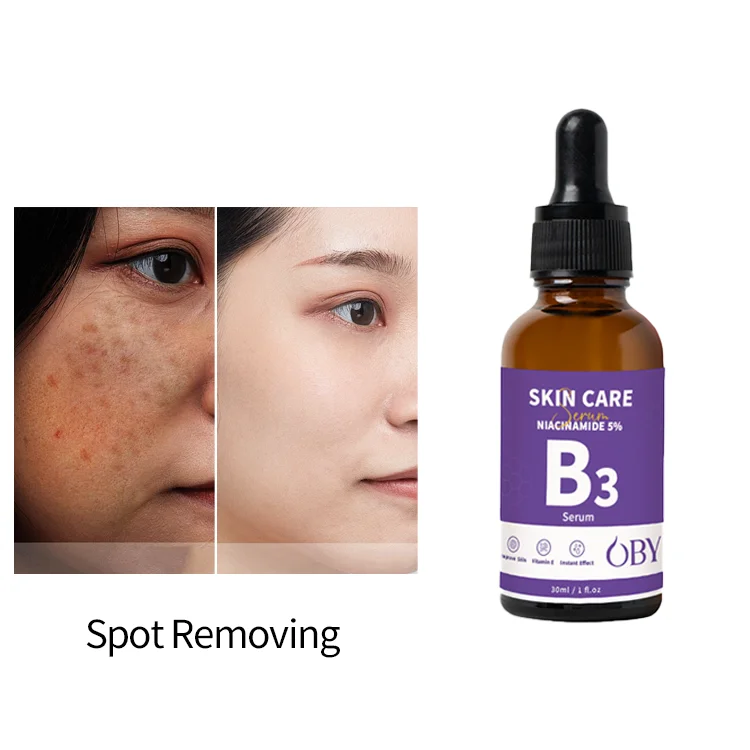 Органическая натуральная Антивозрастная ниацинамидная Сыворотка для лица отбеливающая сыворотка гиалуроновая кислота витамин B3