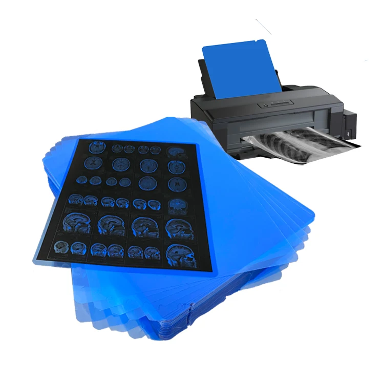 Высококачественная 35x43 струйная синяя медицинская рентгеновская пленка для epson, цифровая рентгеновская пленка для CT