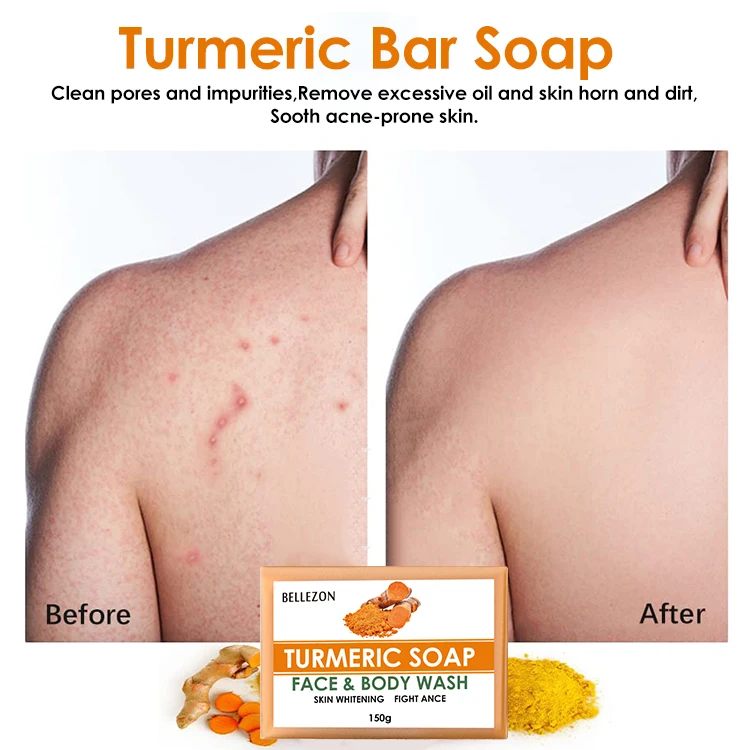 Face Body Turmeric Soap Private Label Anti Acne Brightening Natural Turmeric Soap