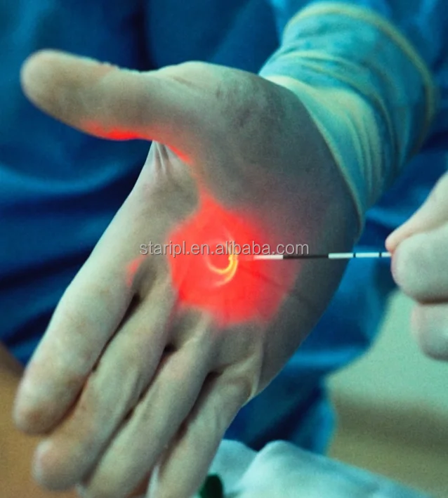 Endolaser diode 980 nm 1470 vaser liposucion 1470nm diode laser single wavelength face lifting endoskin laser devise