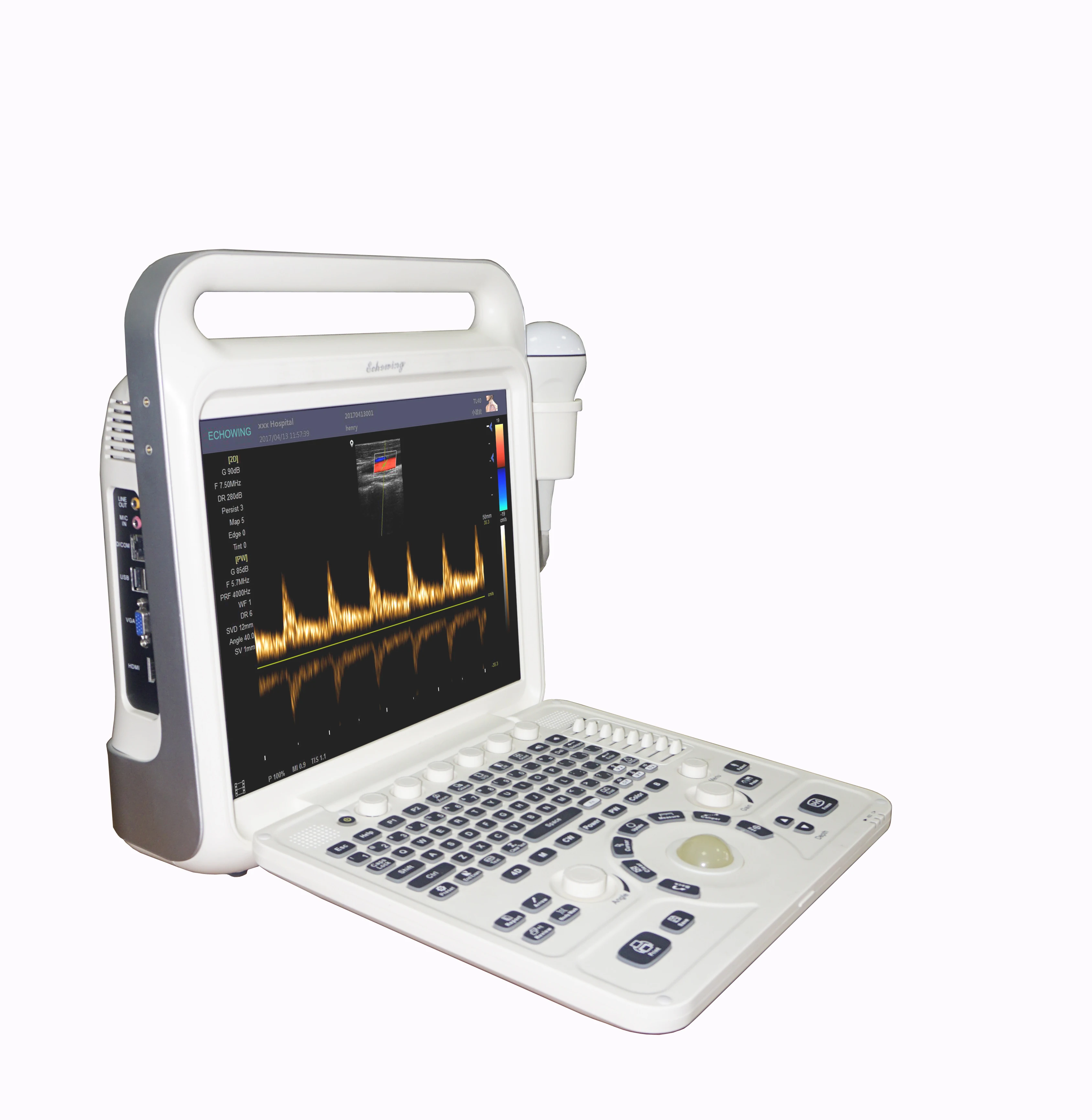 Guangzhou Manufacturer Full Digital Ultrasound Diagnostic System Color Doppler Ultrasound Machine With 3 Probes