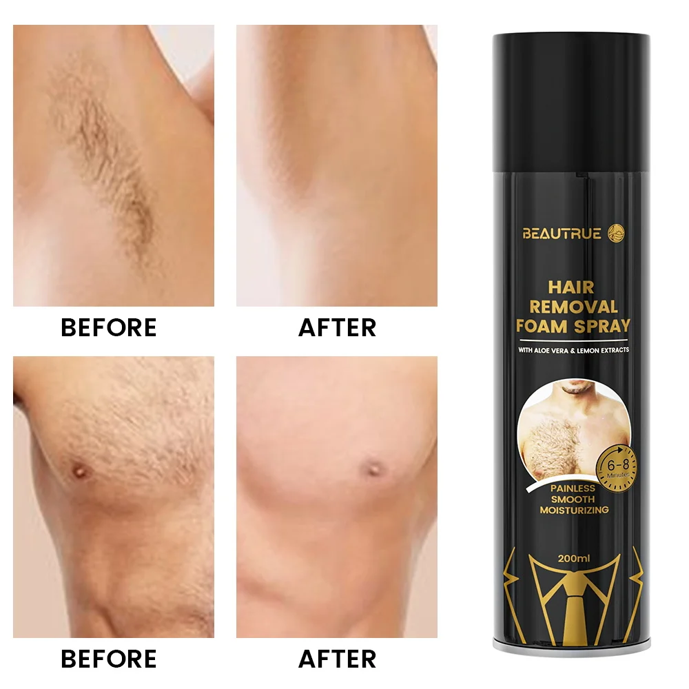 Hot Sale Natural Painless Hair Removal Cream Spray Body Hair Removal Spray For Men Chest Back Legs Under Arms Hair Removal Foam