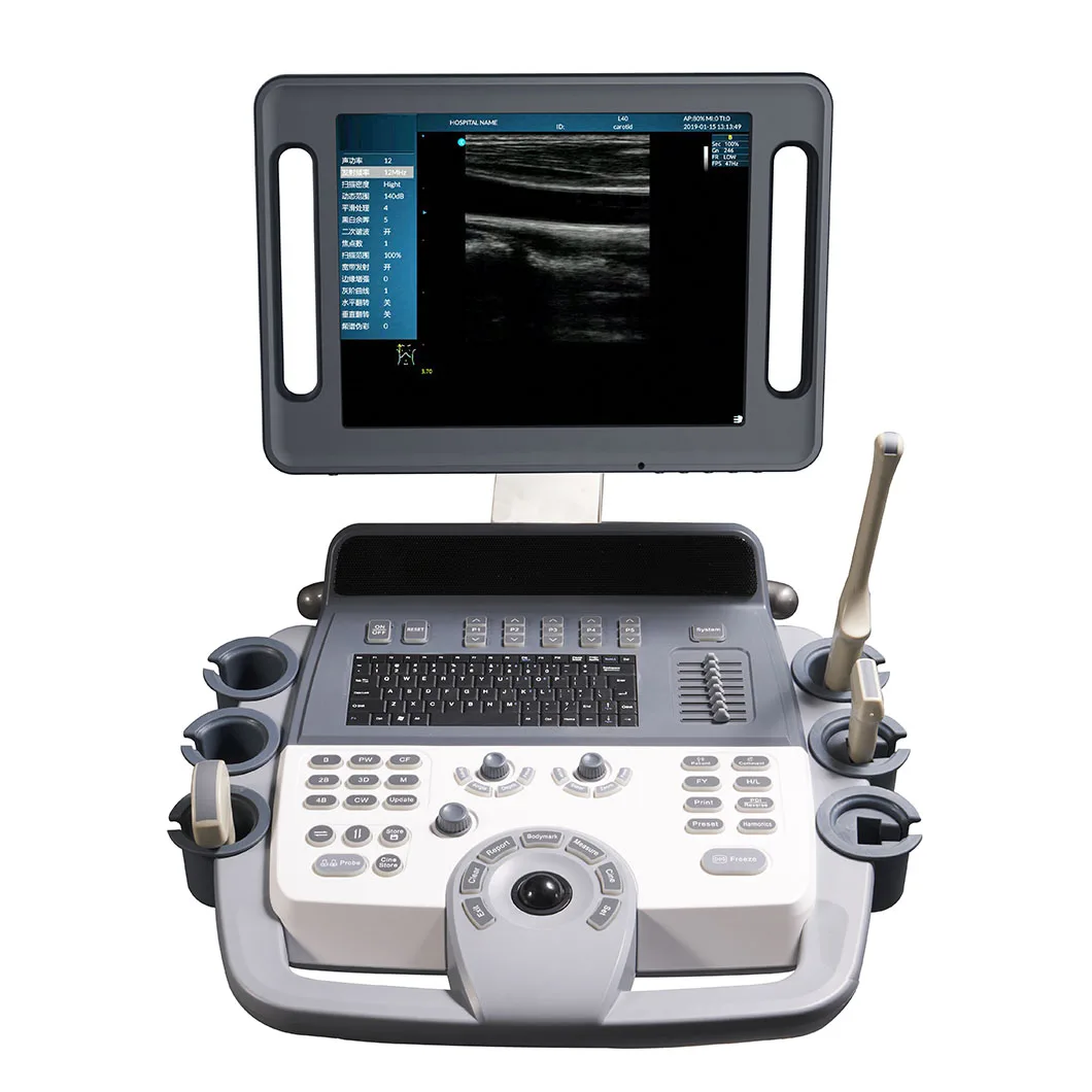 Горячая Распродажа Мобильный аппарат фибросканирования 2D PW THI тележка Цветной Допплер ультразвуковой