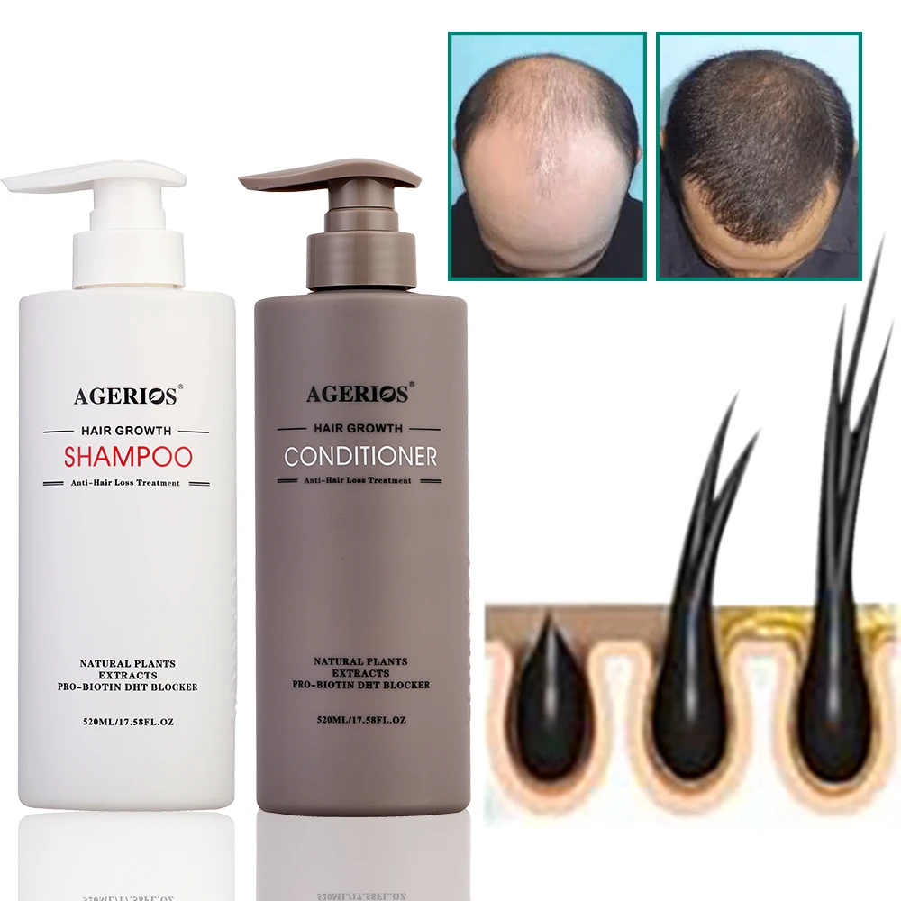 Agerios Natural Anti-Hair Loss Treatment Peppermint Hair Growth Shampoo and Conditioner Therapy