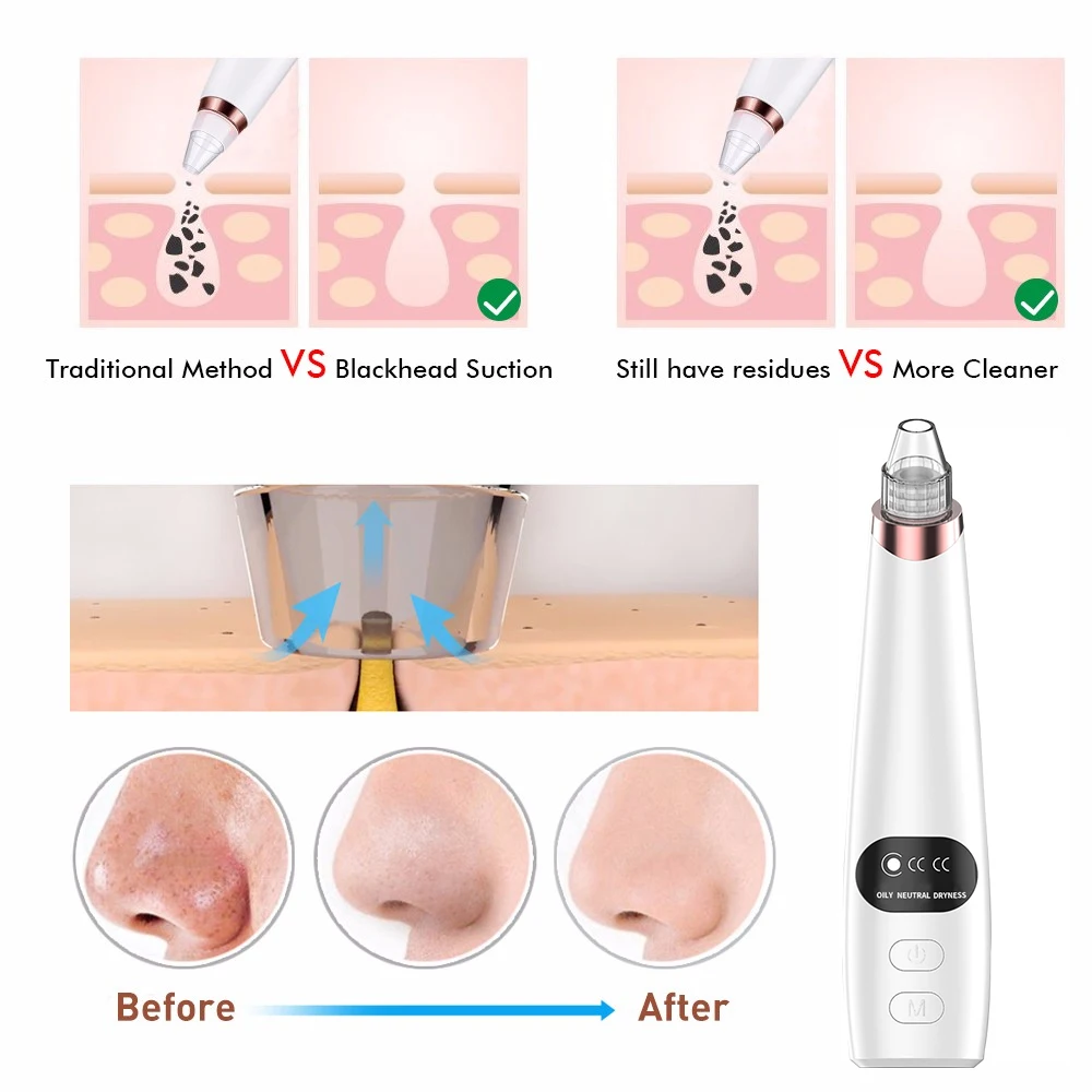 
Oiless vacuum pump rainbow water vacuum cleaner explosion proof vacuum cleaner custom shape insulated panels 