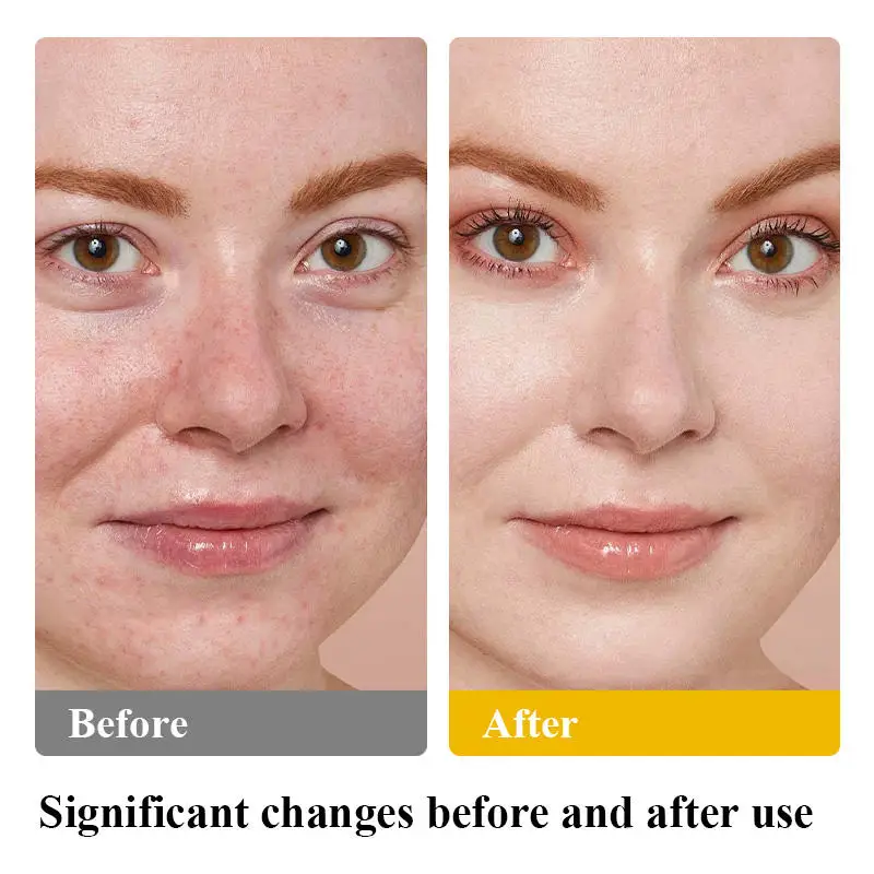 Makeup Peptides Natural Facial Body Lotions Korean Skin Care Products Cosmetic Vitamins Private Label Tallow Balm Face